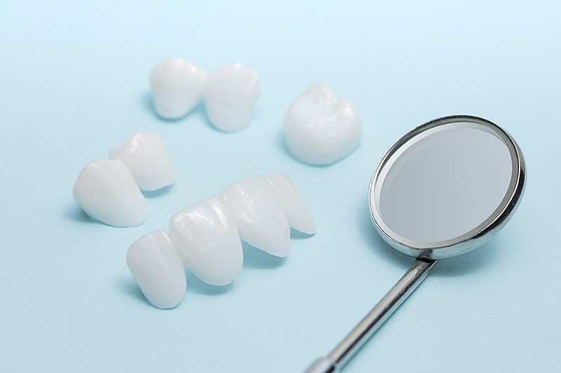 Ästhetische Zahnprothetik